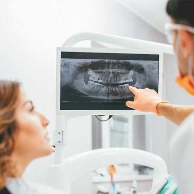 Všetko čo sa oplatí vedieť o zubnom röntgene